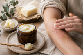 Beef Tallow for Eczema